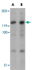 PAB13273 - BUB1A