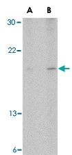 PAB13274 - Antileukoproteinase / ALP