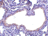 PAB13274 - Antileukoproteinase / ALP