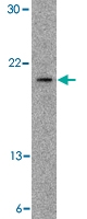 PAB13275 - Antileukoproteinase / ALP