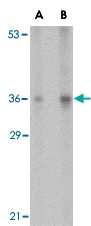 PAB13278 - Interleukin-33 (IL33)