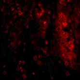 PAB13278 - Interleukin-33 (IL33)