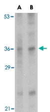 PAB13279 - Interleukin-33 (IL33)