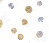 PAB13280 - FYN-binding protein