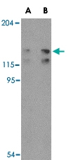 PAB13280 - FYN-binding protein