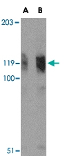 PAB13281 - FYN-binding protein