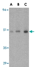PAB13282 - ORAI1