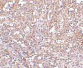 PAB13282 - ORAI1