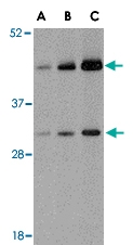 PAB13283 - TARDBP