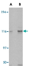 PAB13285 - KIF5A