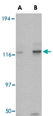 PAB13286 - KIF5A