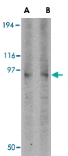 PAB13287 - DISC1