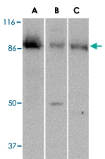 PAB13289 - PTK7 / CCK4