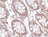 PAB13289 - PTK7 / CCK4