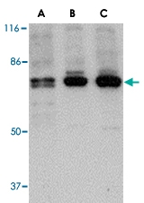 PAB13290 - PTK7 / CCK4