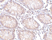 PAB13290 - PTK7 / CCK4