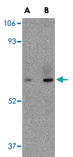PAB13291 - STEAP / STEAP1