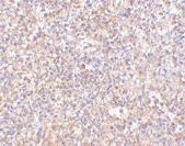 PAB13291 - STEAP / STEAP1