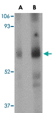 PAB13292 - STEAP / STEAP1