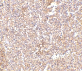 PAB13292 - STEAP / STEAP1