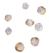 PAB13294 - TRIM25 / RNF147