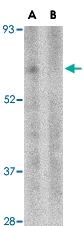 PAB13294 - TRIM25 / RNF147