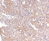 PAB13295 - UIMC1 / RAP80