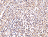 PAB13296 - UIMC1 / RAP80
