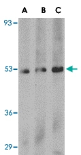 PAB13297 - PLXDC1 / TEM7