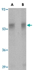 PAB13298 - PLXDC1 / TEM7