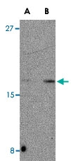 PAB13299 - CDNF