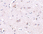 PAB13299 - CDNF