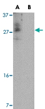 PAB13300 - CDNF