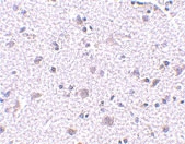 PAB13300 - CDNF
