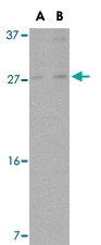 PAB13302 - ARMET / ARP
