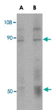 PAB13303 - CD248 / TEM1