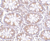 PAB13303 - CD248 / TEM1