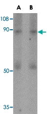 PAB13304 - CD248 / TEM1