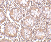PAB13304 - CD248 / TEM1
