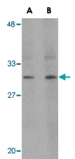 PAB13305 - RASD2 / TEM2