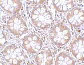 PAB13305 - RASD2 / TEM2
