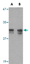PAB13306 - RASD2 / TEM2