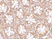 PAB13306 - RASD2 / TEM2