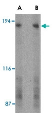 PAB13307 - GPR124 / TEM5