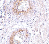PAB13307 - GPR124 / TEM5
