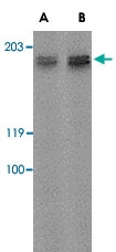 PAB13308 - GPR124 / TEM5
