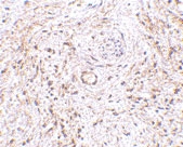 PAB13308 - GPR124 / TEM5