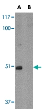 PAB13309 - FNBP1L