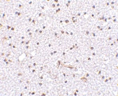 PAB13309 - FNBP1L