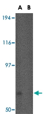 PAB13310 - FNBP1L